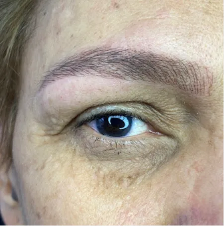Antes e depois de micropigmentação de sobrancelha feita no estúdio